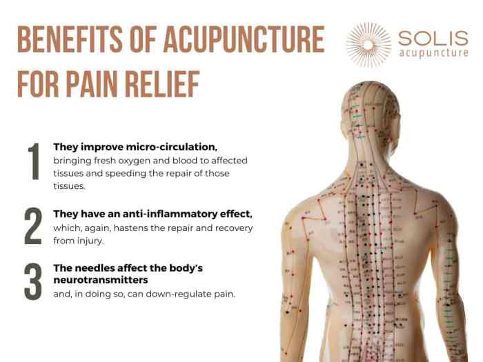 Acupuncture pain back works nerve explains doctor sciatica common sciatic causes Acupuncture for pain relief